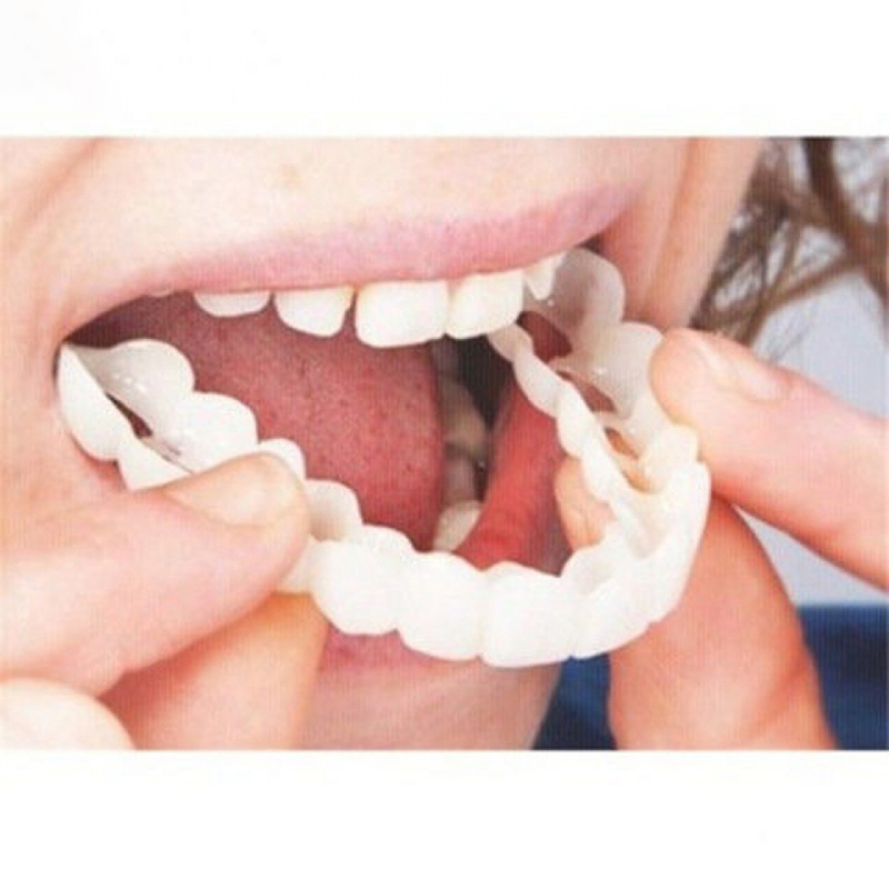 Teeth Whitening For Braces - Perfect Fit Valse Tanden Cover Whitening