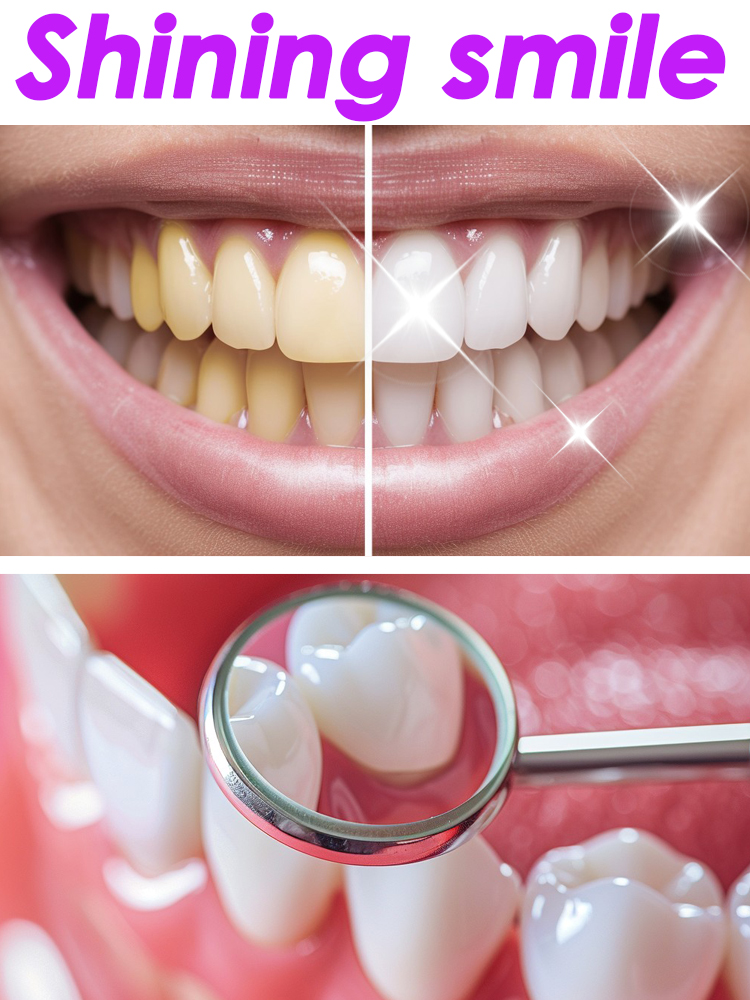 Teeth Whitening Xylitol - GlorySmile Tanden Whitening Fruitige Tandpasta Producten