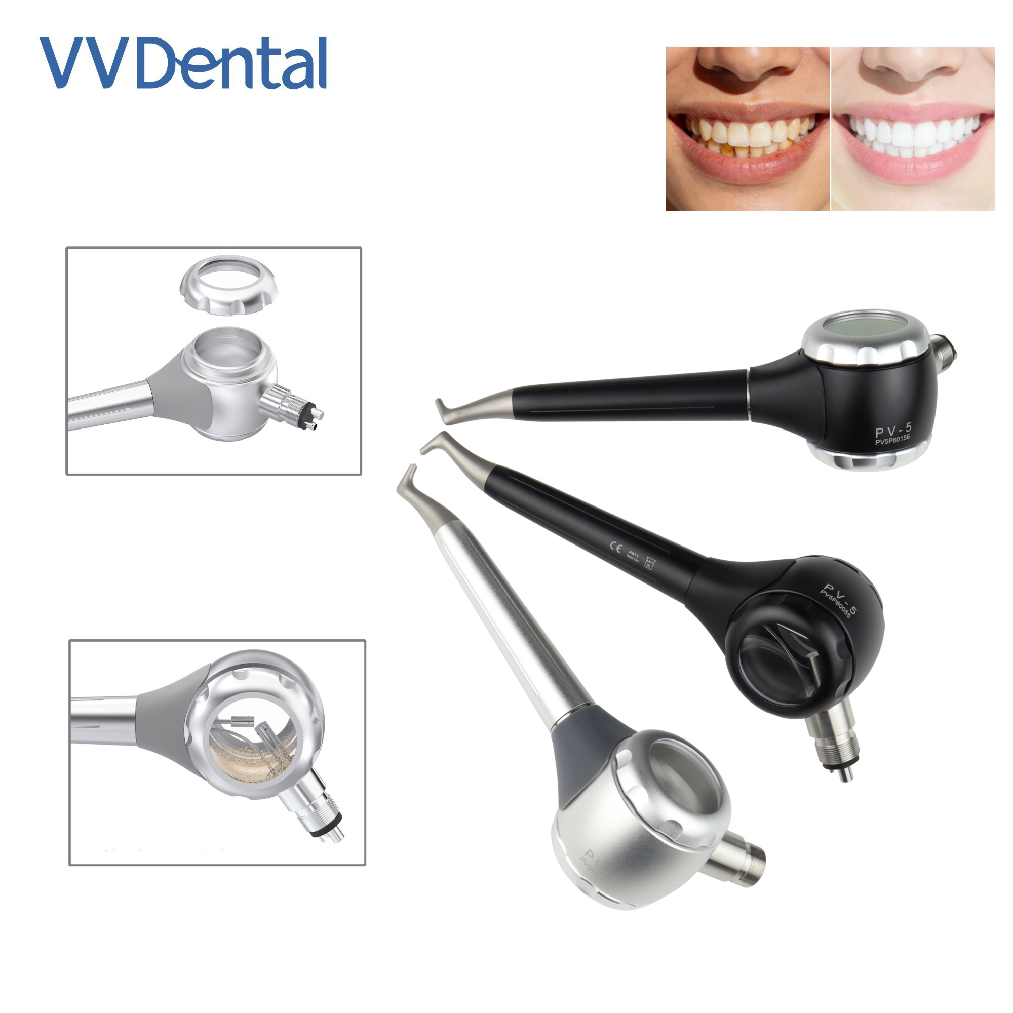 Teeth Whitening Usa - VV Dental 2/4 Gaten Tanden Whitening