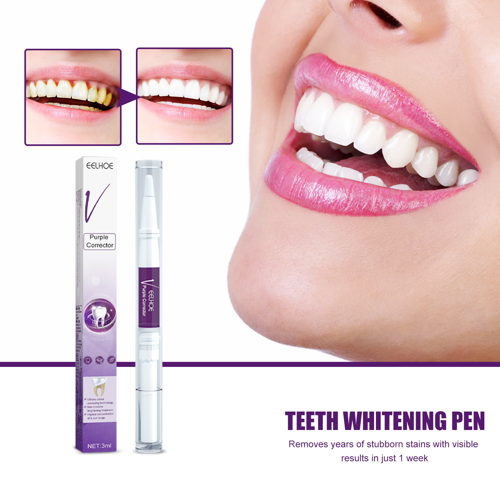 Whitening Pen Bleach - Paarse Tanden Whitening Tandpasta Pen Verwijderen