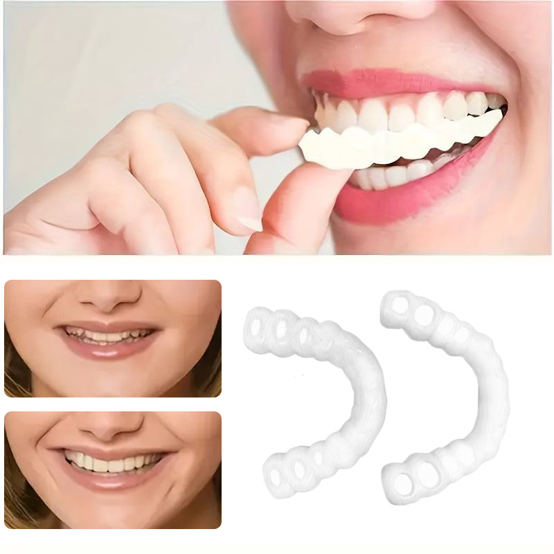 Teeth Whitening For Braces - On Smile Dental Boven- en Ondergebit