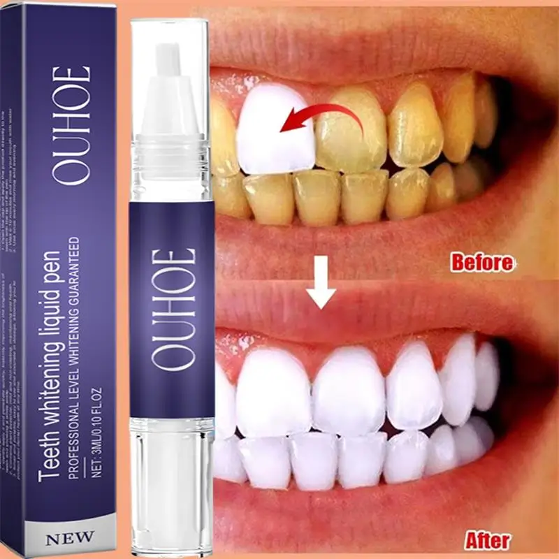 Whitening Pen Bleach - Snelle Tanden Whitening Tandpasta Pen Verwijderen