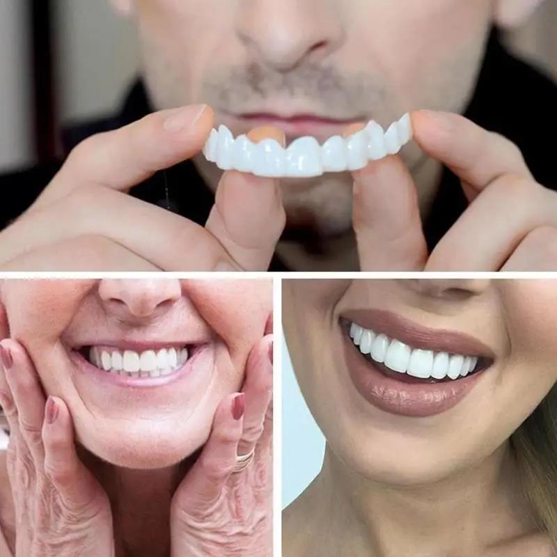 Nieuwe tanden Veneers Whitenin - Teeth Whitening For Braces recensie en prijs