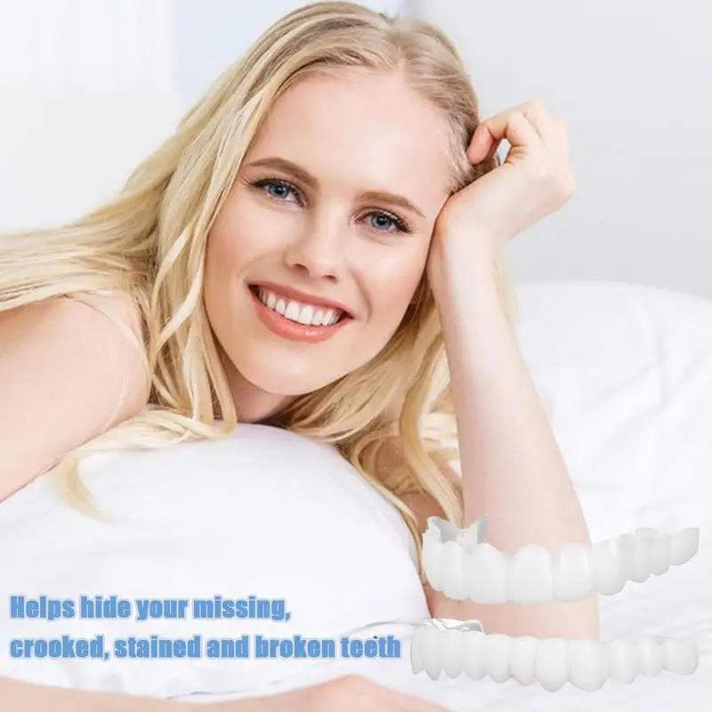 Nieuwe tanden Veneers Whitenin - Teeth Whitening For Braces recensie en prijs