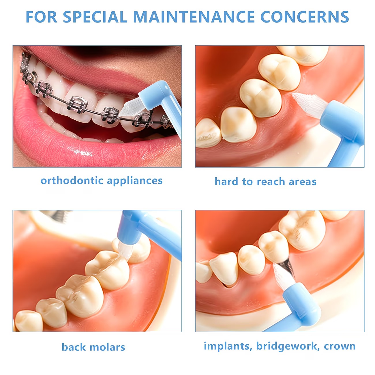1/3pc Orthodontische beugel ta - Teeth Whitening For Braces recensie en prijs