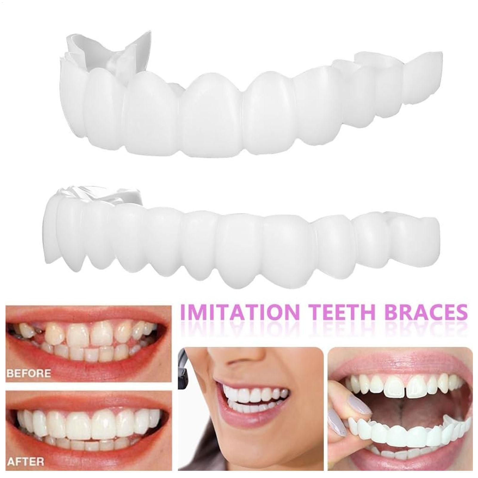 Tandenprotheses voor boven- en - Teeth Whitening For Braces recensie en prijs