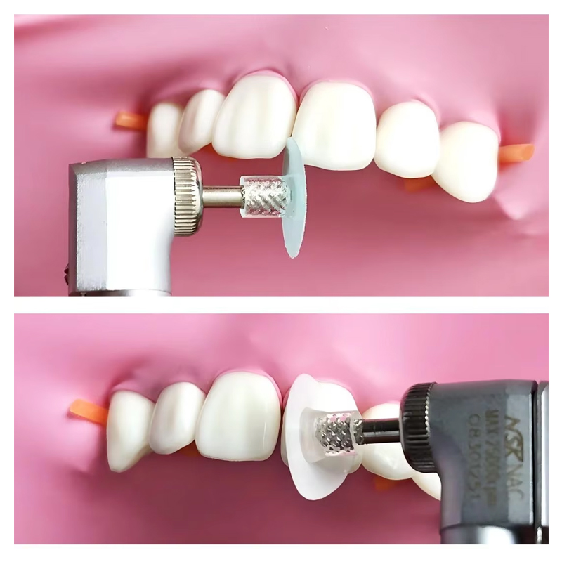 40 Stuks Tandheelkundige Polij - Teeth Whitening Professional recensie en prijs