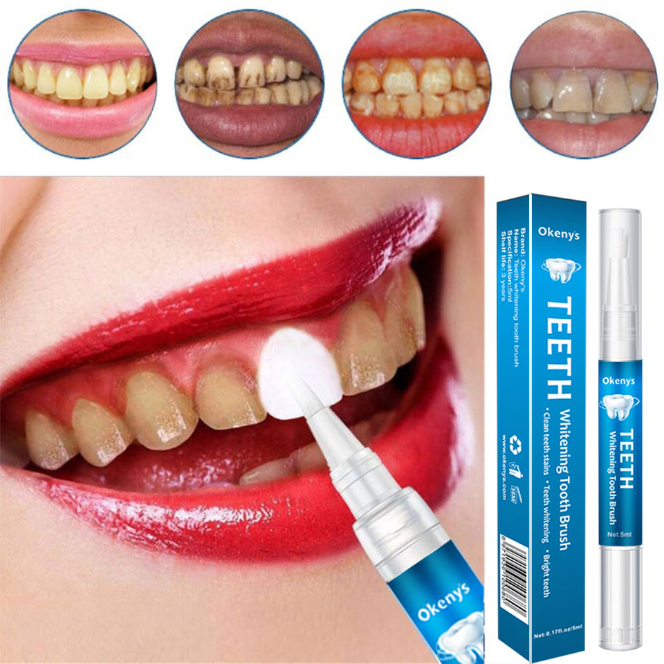 5Ml Tanden Whitening Kit Schoo - Teeth Whitening Xylitol recensie en prijs