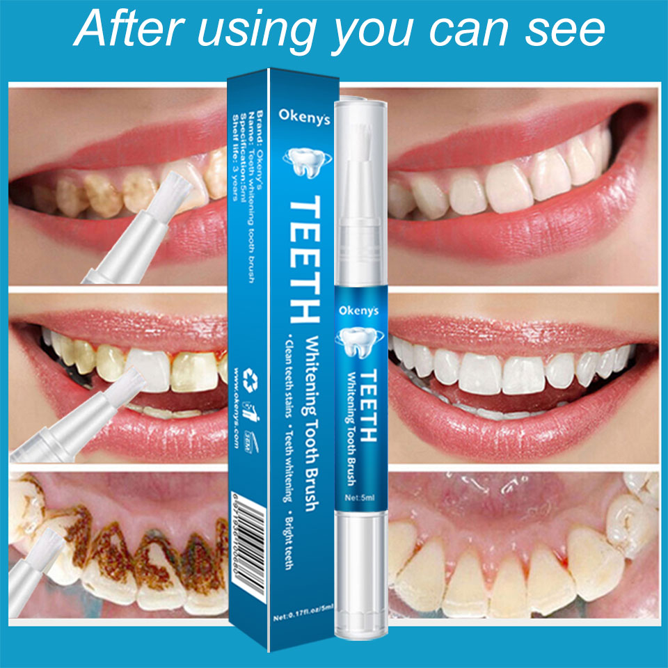 5Ml Tanden Whitening Kit Schoo - Teeth Whitening Xylitol recensie en prijs