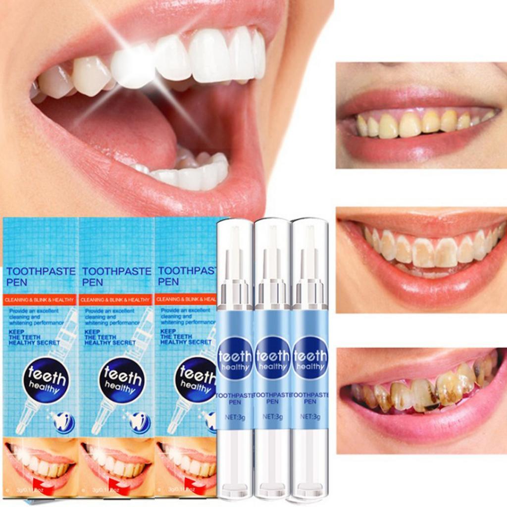 2-4 stuks Whitening Pen Whiten - Whitening Pen Bleach recensie en prijs