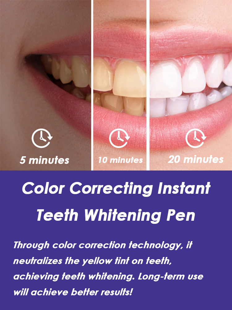 Tandenbleekpen Effectief verwi - Whitening Pen Bleach recensie en prijs