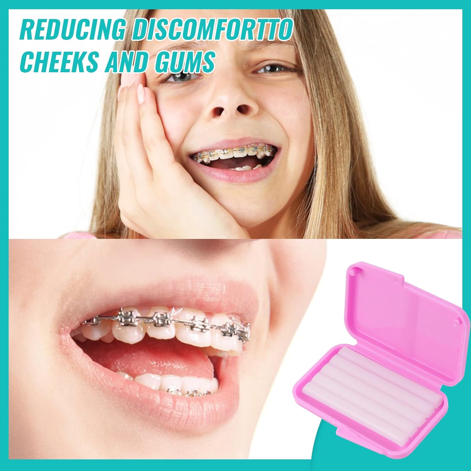 10 doos Tandheelkundige Orthod - Teeth Whitening For Braces recensie en prijs
