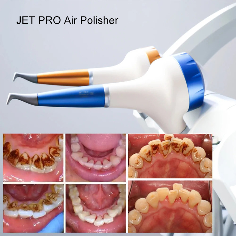 VV Dental Air Polishing Prophy - Teeth Whitening Usa recensie en prijs