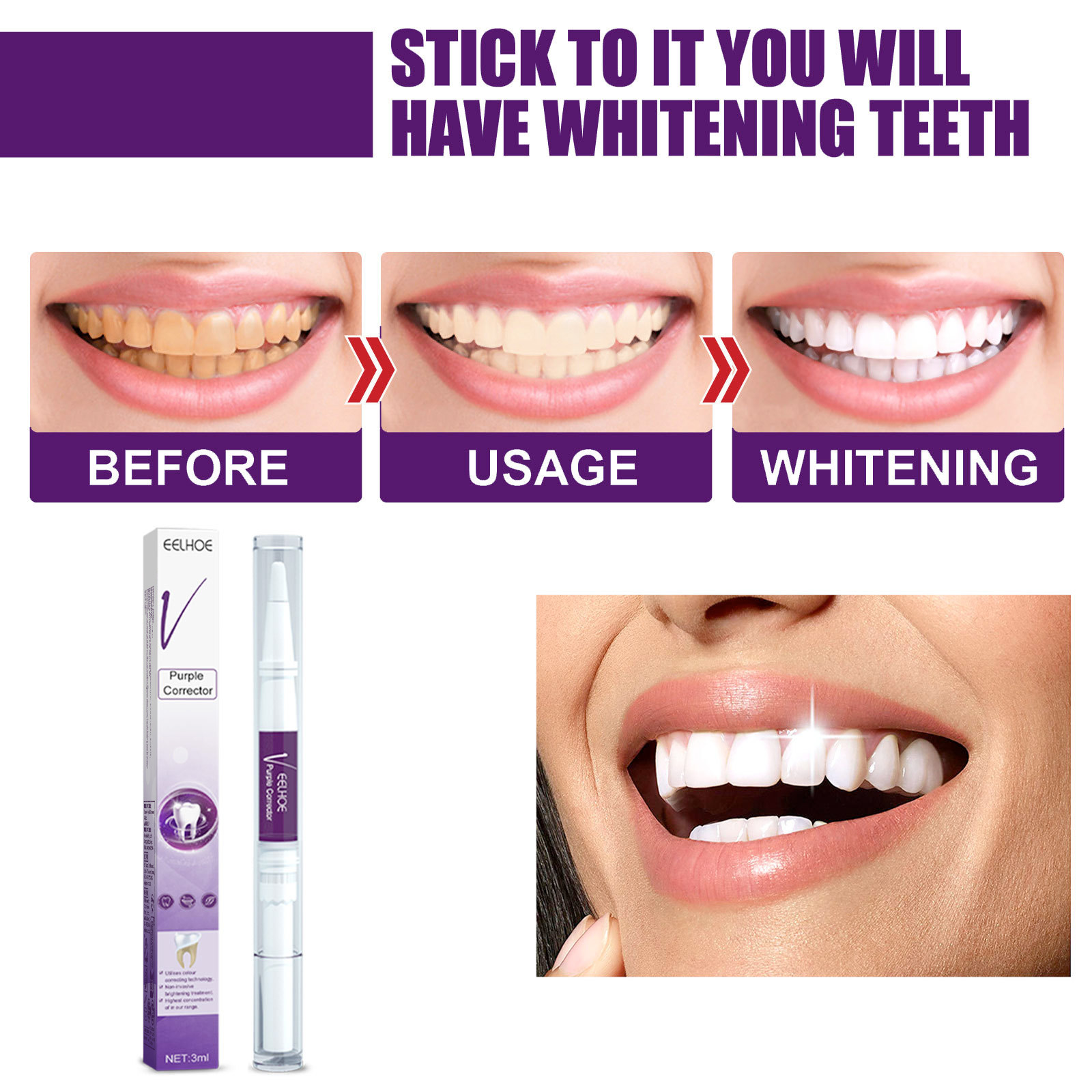 Paarse Tanden Whitening Tandpa - Whitening Pen Bleach recensie en prijs