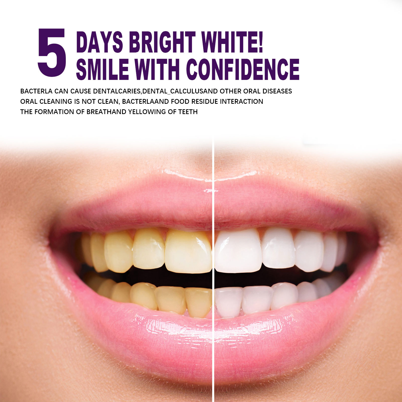 Paarse Tanden Whitening Tandpa - Whitening Pen Bleach recensie en prijs