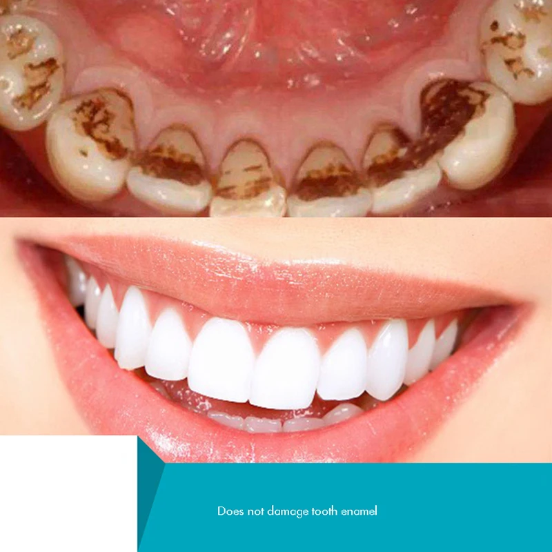 Kruiden Tand Poeder, Natuurlij - Teeth Whitening Xylitol recensie en prijs