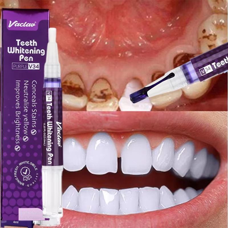 V34 Tanden Whitening Pen Tandp - Whitening Pen Bleach recensie en prijs