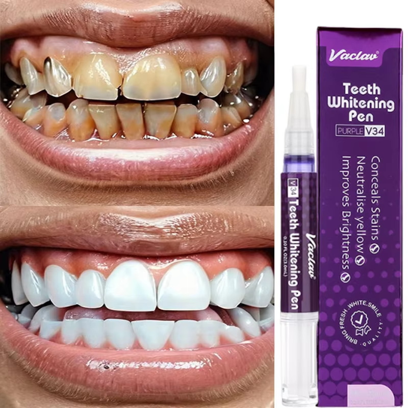 V34 Tanden Whitening Pen Tandp - Whitening Pen Bleach recensie en prijs