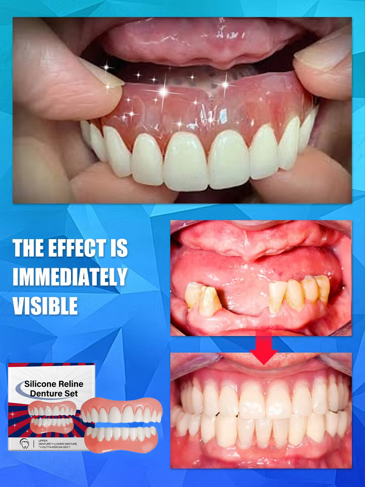 Valse tanden Siliconen bovenst - Teeth Whitening For Braces recensie en prijs