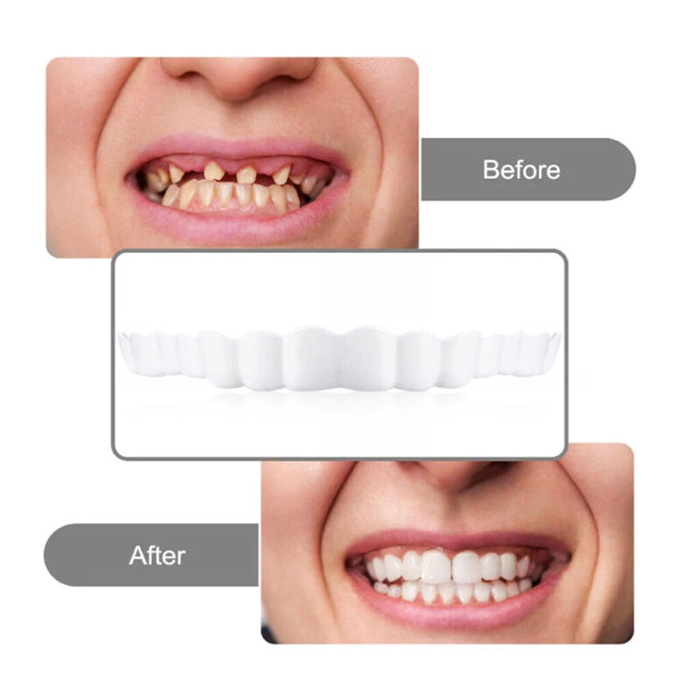 2026icone Prothese Set Fit Tij - Teeth Whitening Usa recensie en prijs