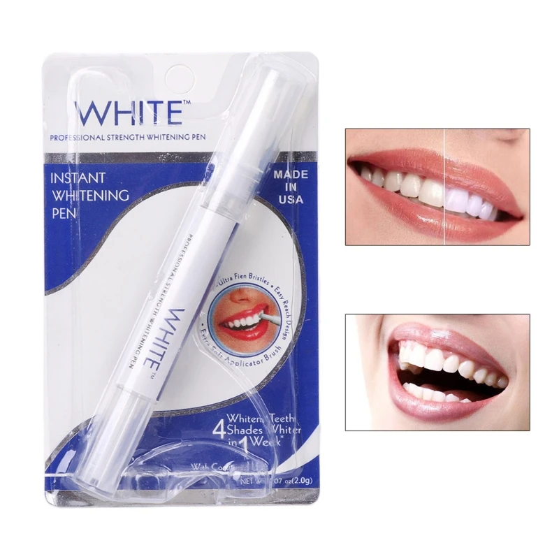 Instant White Teeth Whitening  - Whitening Pen Bleach recensie en prijs