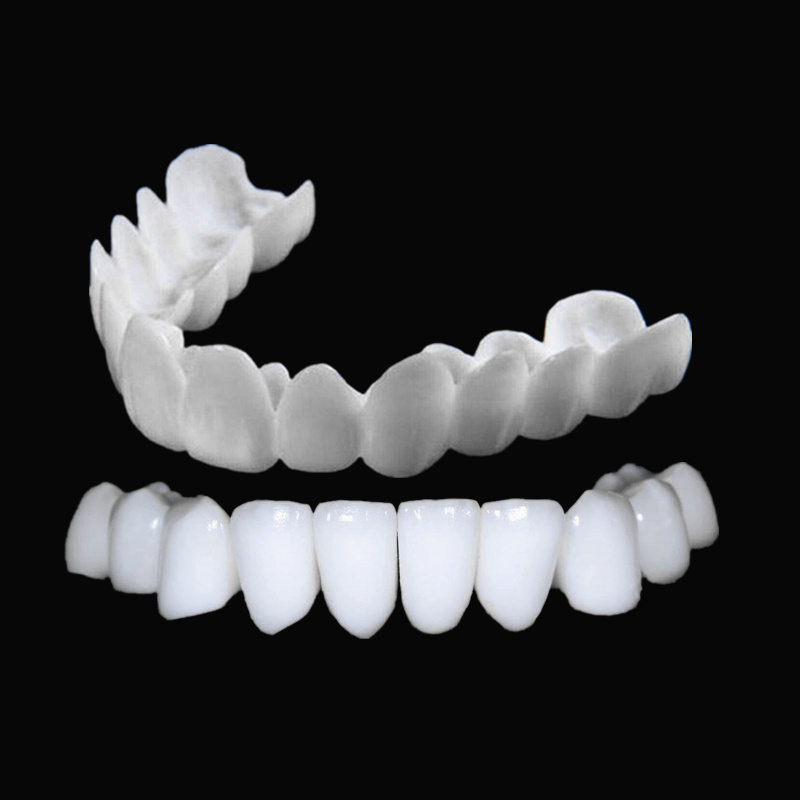 On Smile Dental Boven- en Onde - Teeth Whitening For Braces recensie en prijs