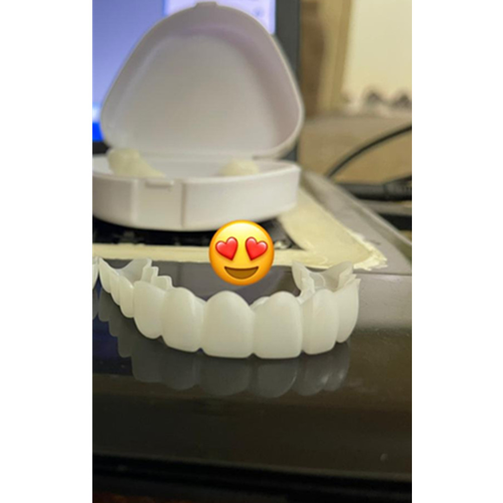On Smile Dental Boven- en Onde - Teeth Whitening For Braces recensie en prijs