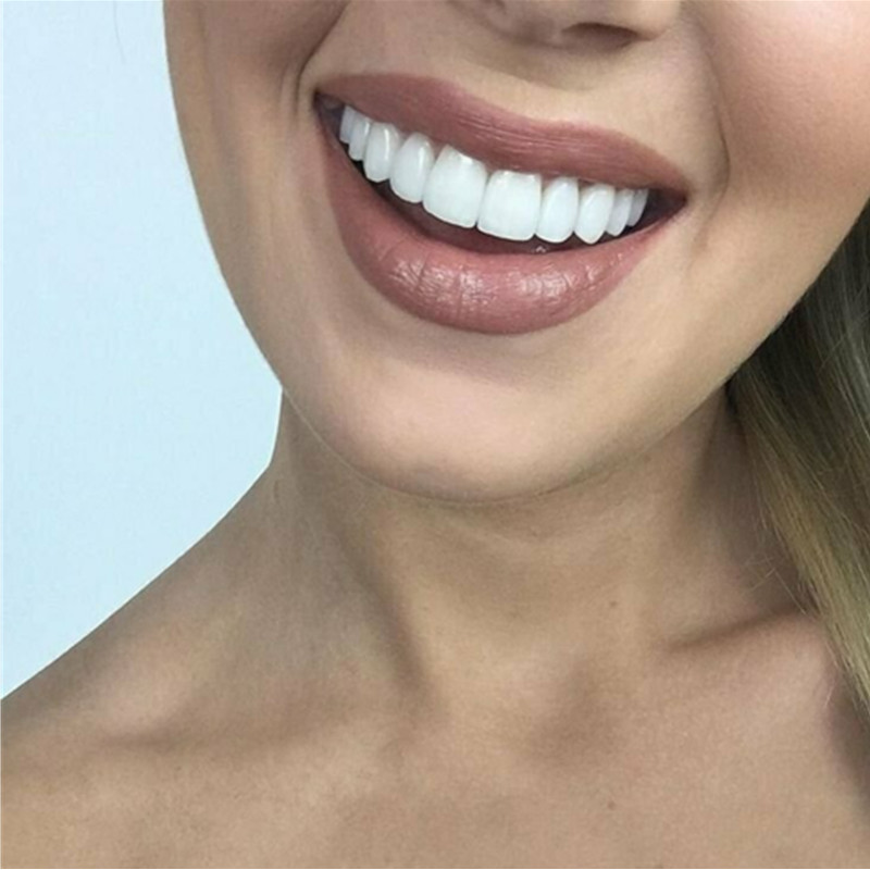 On Smile Dental Boven- en Onde - Teeth Whitening For Braces recensie en prijs