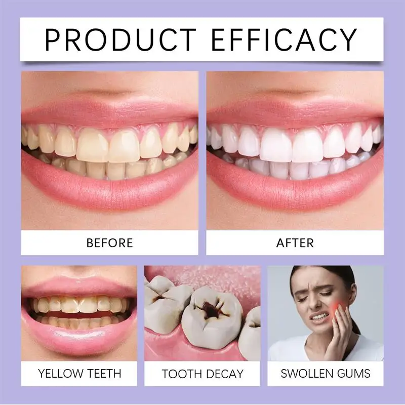 Snelle Tanden Whitening Tandpa - Whitening Pen Bleach recensie en prijs