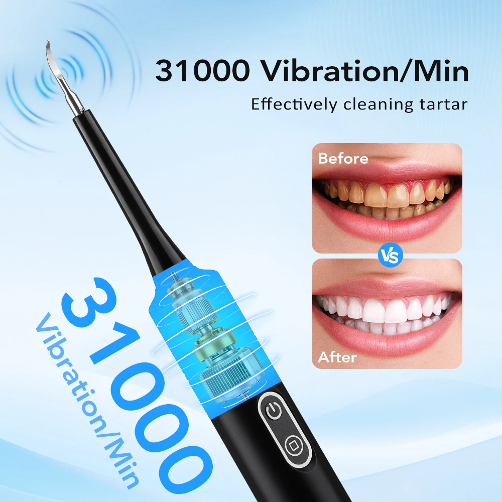 Elektrische sonische vibratie  - Teeth Whitening Professional recensie en prijs